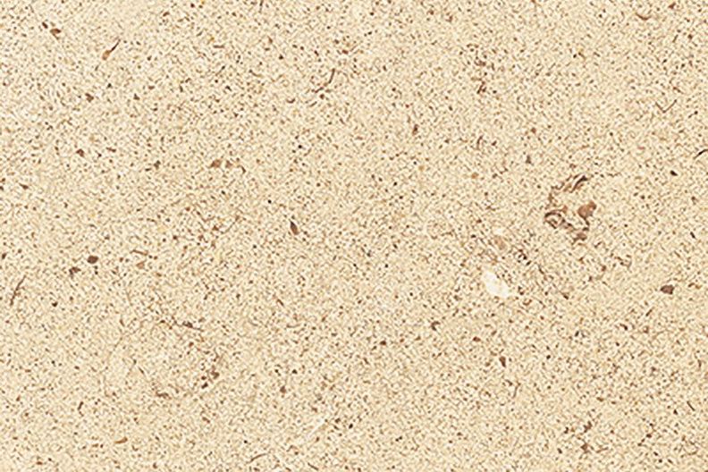 Portugal Beige Marble